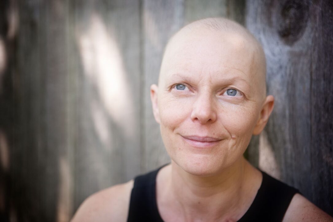 Chemotherapy hair loss